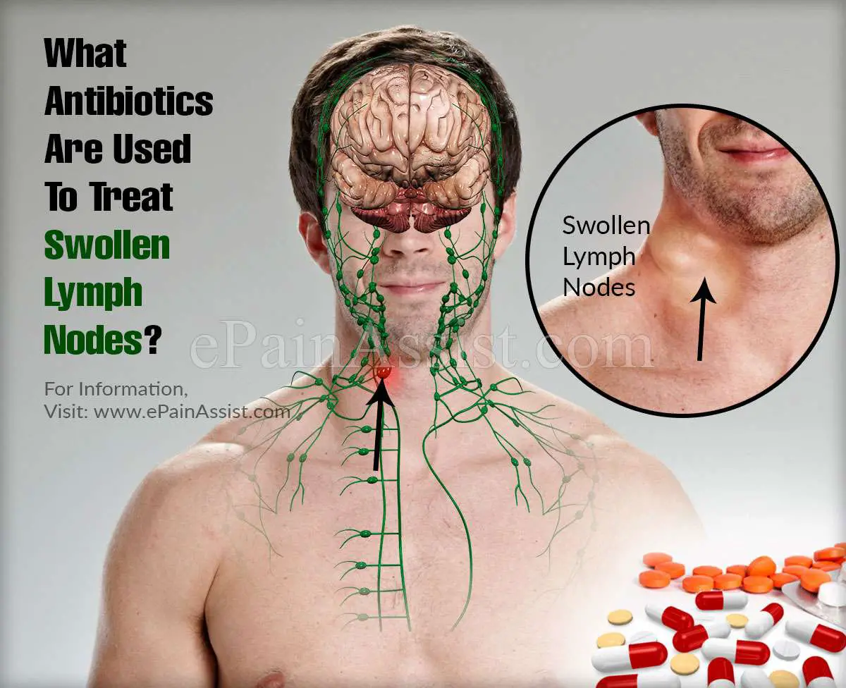 What Antibiotics Are Used To Treat Swollen Lymph Nodes?