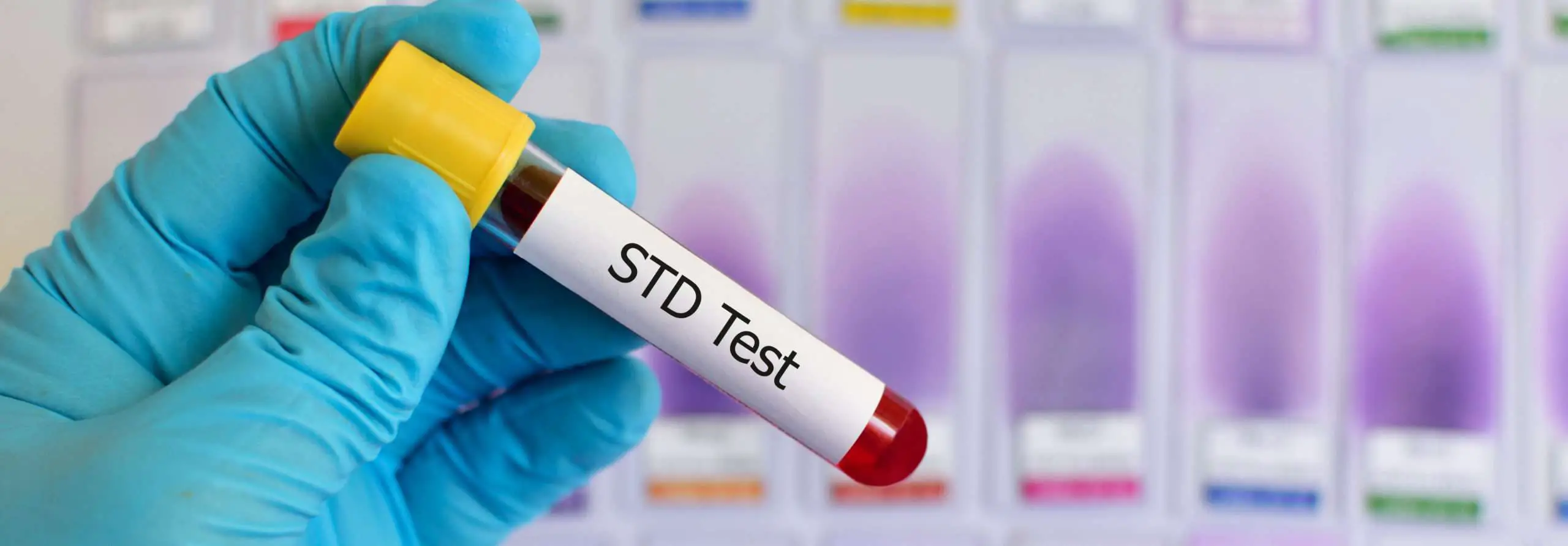 What are the Most Common STDs and How Do You Get Rid of Them?