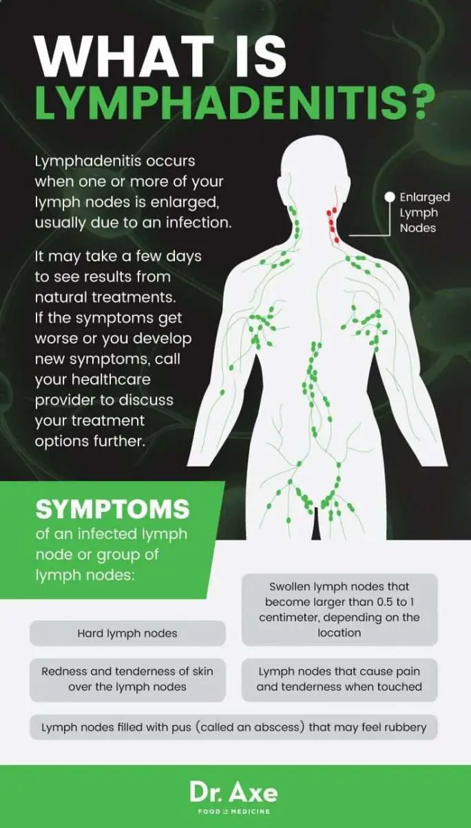 What is lymphadenitis?