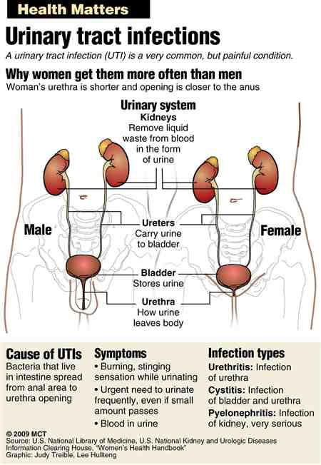 Yeast Infection From Stress Urinary Tract